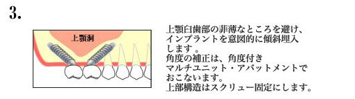 健康な上顎骨の質量と高さ