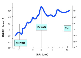 歯科で使われるレーザーの種類