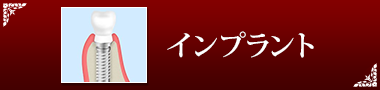 インプラント