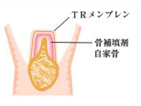 断面図