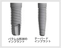 インプラントの形状の進化（2003年～）