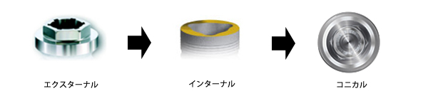 アバットメント接続の進化1（垂直的な接続様式の進化）