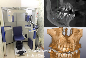 2. 歯科用CT